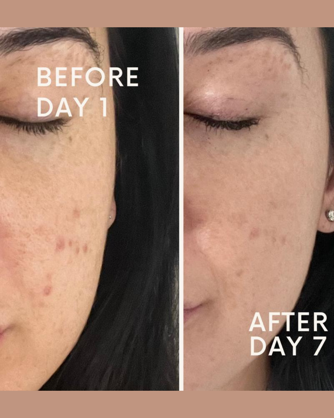 Skincare-Results-Before-After